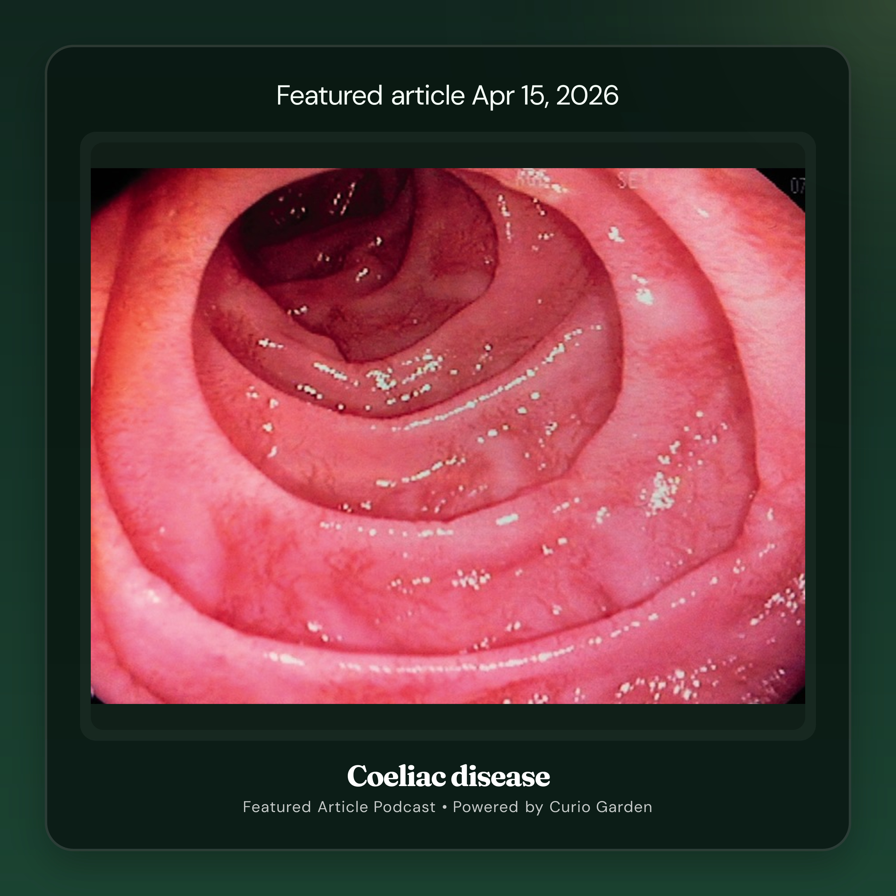 Artwork for Coeliac disease